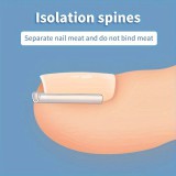 50db Benőtt Köröm Korrekciós Csíkok - Légáteresztő és Rugalmas Pedikűr Eszköz a Fájdalomcsillapításért és Köröm Egészségéért