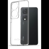 AlzaGuard Crystal Clear Honor X7b TPU tok (AGD-PCT401Z)
