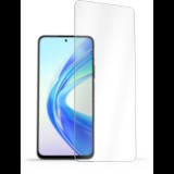 AlzaGuard Glass Protector Honor X7b 2.5D üvegfólia - Case Friendly (AGD-TGF252)