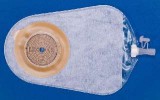 Coloplast Alterna üríthető egyrészes urostomás zsákok öntapadó (maxi méret) 15 db