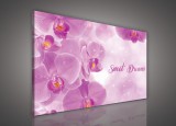 Consalnet Vászonkép, Sweet Dreams Orchidea 100x75 cm méretben