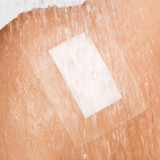 CURAPOR TRANSPARENT vízálló szigetkötszer 10x25cm