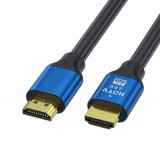 Ezone Nagy sebességű HDMI kábel 2.0v, 4K, 60Hz, 1.5 méter, kompatibilis Apple TV, Samsung QLED TV, 3D-Xbox, PS4, fekete-kék