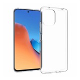 Gigapack Xiaomi Redmi 12 szilikon telefonvédő (ultravékony) átlátszó