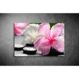 Hibiszkusz Vászonkép 059 vi-059