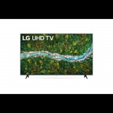 LG 50UP77003LB 55" 4K HDR Smart UHD TV (50UP77003LB) - Televízió