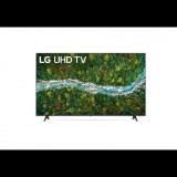 LG 65UP76703LB 65" 4K HDR Smart UHD TV (65UP76703LB) - Televízió