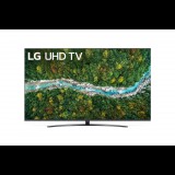 LG 75UP78003LB 75" 4K HDR Smart UHD TV (75UP78003LB) - Televízió