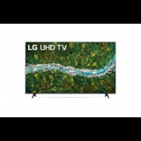LG 50UP76703LB 50" 4K HDR Smart UHD TV (50UP76703LB) - Televízió