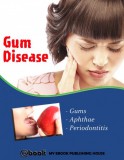 My Ebook Publishing House: Gum Disease - könyv