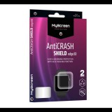 MYSCREEN ANTI CRASH EDGE képernyővédő fólia (3D, full cover, íves, karcálló, ütésálló, 0.2 mm, 6H) ÁTLÁTSZÓ [Apple Watch Series 7 45mm] (M6177CAOFS) - Kijelzővédő fólia