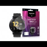 MyScreen Protector AntiCrash Shield Edge3D Realme Watch S Pro ütésálló kijelzővédő fólia (LA-2136) (LA-2136) - Kijelzővédő fólia