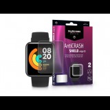 MyScreen Protector AntiCrash Shield Edge3D Xiaomi Mi Watch Lite ütésálló képernyővédő fólia 2db/csomag (LA-1921) (LA-1921)