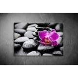Orchidea Vászonkép 007 vi-007