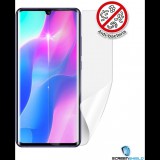 Screenshield Anti-Bacteria XIAOMI Mi Note 10 Lite kijelzővédő fólia (XIA-MINOTE10LTAB-D)