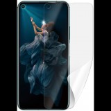 Screenshield HONOR 20 kijelzővédő fólia (HUA-HON20PR-D)
