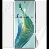 Screenshield Honor Magic 5 lite 5G teljes készülékre (HUA-HONM5LT5G-B)