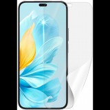 Screenshield HUAWEI Honor 200 Lite védőfólia (HUA-HON200LT-D)