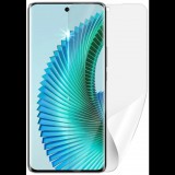 Screenshield HUAWEI Honor Magic 6 Lite 5G védőfólia (HUA-HONM6LT5G-D)