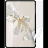 Screenshield HUAWEI Honor Pad 9 védőfólia (HUA-HONP9-D)