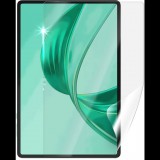 Screenshield HUAWEI Honor Pad X8a védőfólia (HUA-HONPX8A-D)