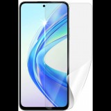 Screenshield HUAWEI Honor X7b védőfólia (HUA-HONX7B-D)