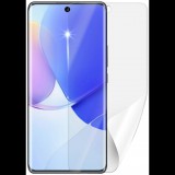 Screenshield HUAWEI Nova 9 kijelzővédő fólia (HUA-NOVA9-D)
