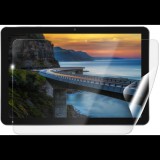 Screenshield IGET Smart W30 védőfólia (IGT-SMW30-D)