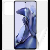 Screenshield XIAOMI 11T kijelzővédő fólia (XIA-11T-B)