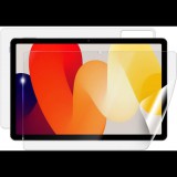 Screenshield XIAOMI Redmi Pad SE teljes készülékre (XIA-REDMIPADSE-B)