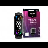 Xiaomi Mi Smart Band 5/Mi Smart Band 6 ütésálló képernyővédő fólia - MyScreen Protector AntiCrash Shield Edge3D - 2 db/csomag - transparent (LA-1938)