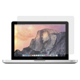 Xprotector XPRO™ Matt kijelzővédő fólia Apple MacBook Pro 13.3" (2016-2020) / Air 13.3" (2018-2019) készülékhez