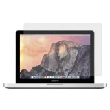 Xprotector XPRO™ Ultra Clear kijelzővédő fólia MacBook Air 13,3' Retina (2018-2020) készülékhez